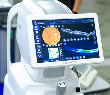 OCT - Optische Kohärenztomographie