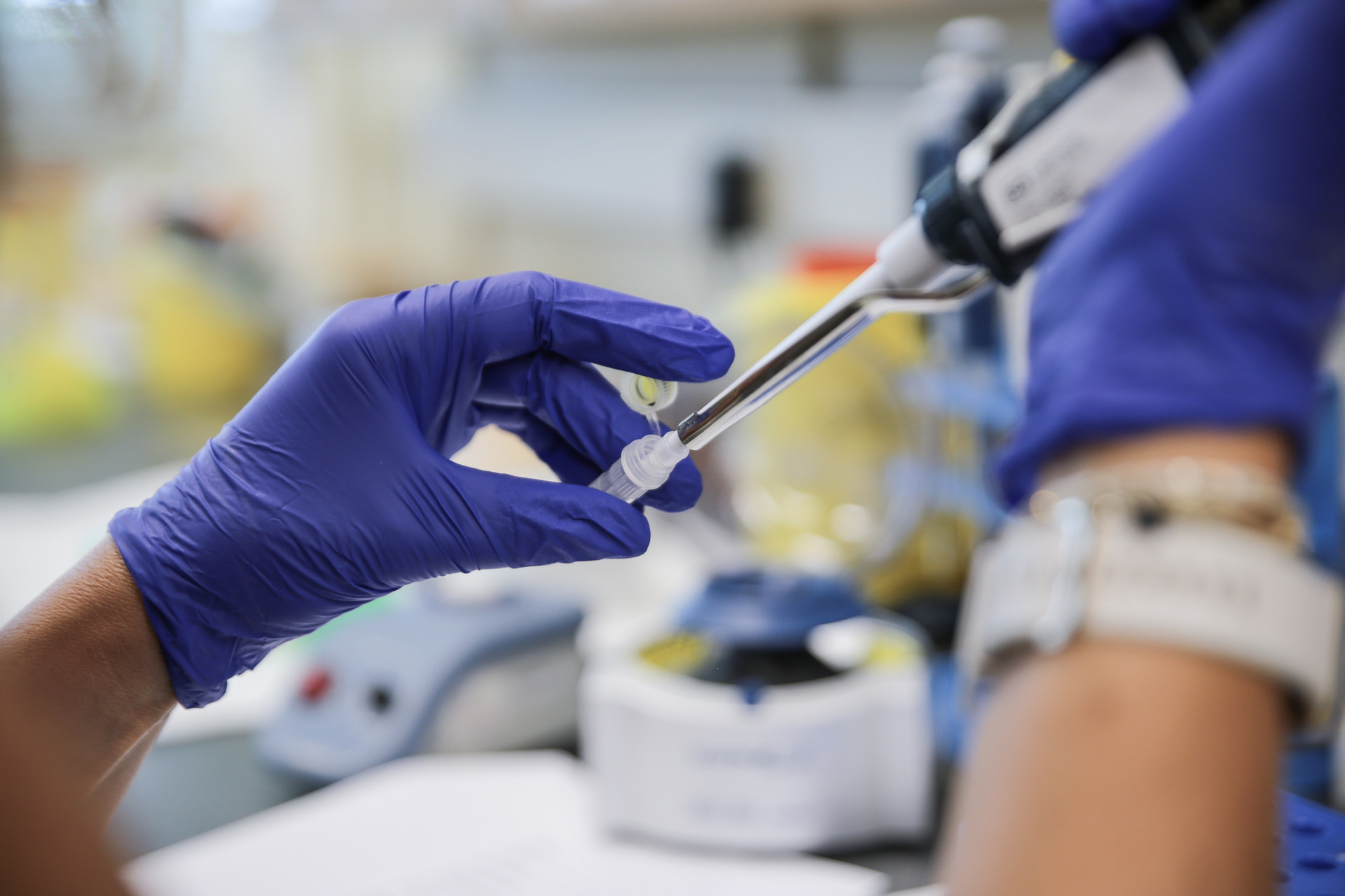 A laboratory technician prepares the samples of the monkeypox for PCR diagnosis