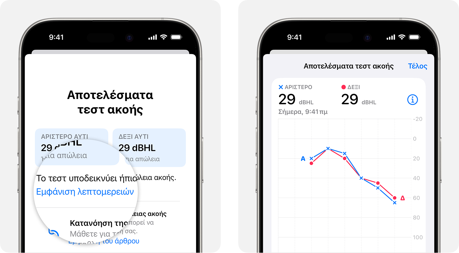Λεπτομερή αποτελέσματα τεστ ακοής που πραγματοποιήθηκε με τα AirPods Pro 2 σε iPhone.