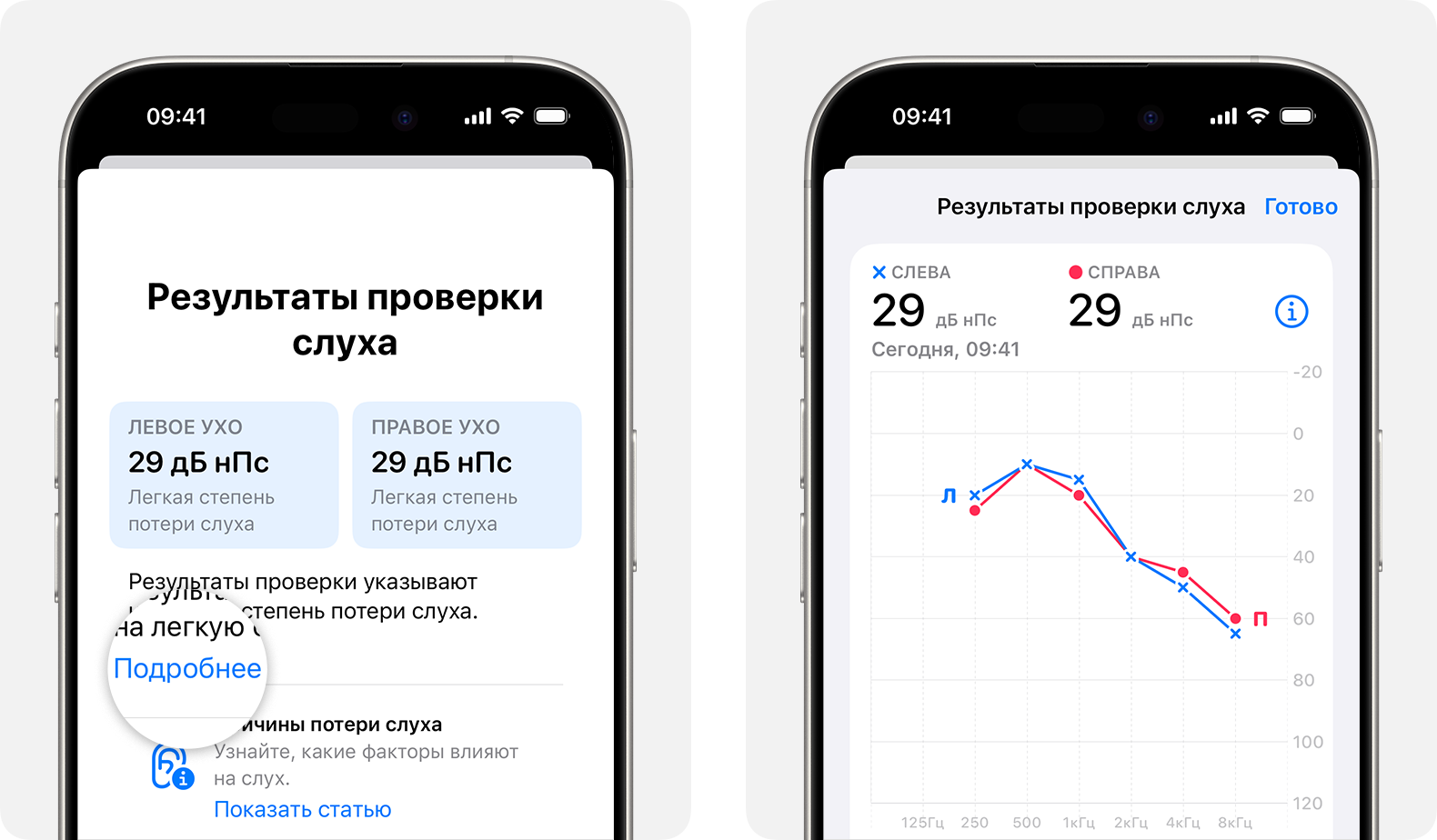 Подробные результаты проверки слуха, сделанной с помощью AirPods Pro 2 и iPhone.