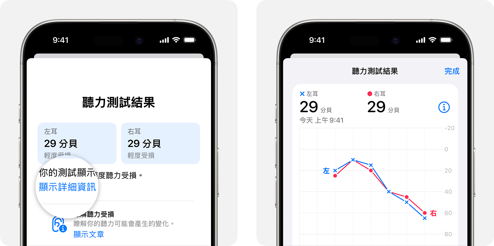 在 iPhone 上透過 AirPods Pro 2 進行聽力測試後的詳細結果。