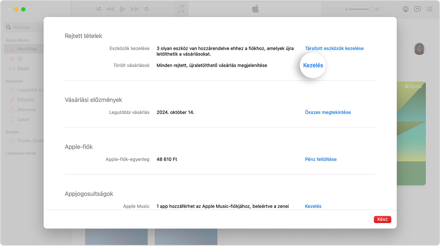 A Fiókbeállítások képernyő a Macen található Apple Music appban. A Rejtett elemek szövegtől jobbra a Kezelés gomb látható.