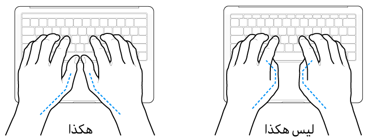 يدان موضوعتان على لوحة مفاتيح، ويظهر الوضع الصحيح وغير الصحيح للإبهامين.