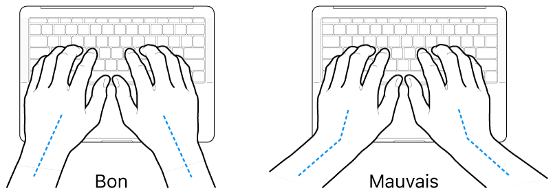 Mains placées sur un clavier, montrant le bon et le mauvais alignement des poignets et des mains.