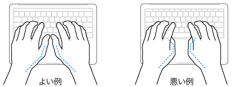 キーボードに置かれた手。親指の適切な位置と不適切な位置を示しています。