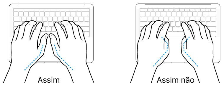 As mãos posicionadas sobre um teclado a mostrar a colocação correta e incorreta dos polegares.