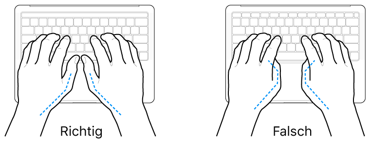 Tastatur und Hände in richtiger und falscher Haltung der Daumen