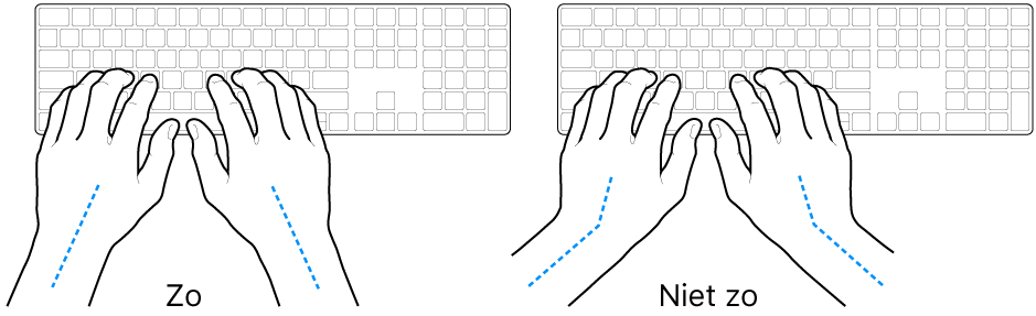 Handen boven een toetsenbord, waarbij de goede en verkeerde stand van de handen en polsen wordt aangegeven.