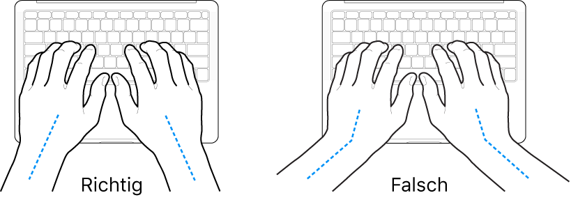 Tastatur und Hände in richtiger und falscher Haltung von Handgelenk und Händen