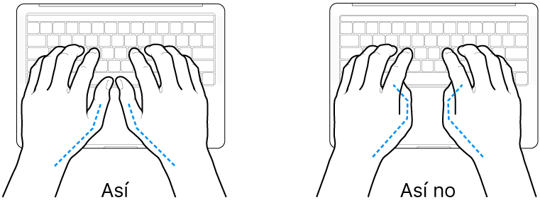 Manos posicionadas sobre un teclado, mostrando la alineación correcta e incorrecta de los pulgares.