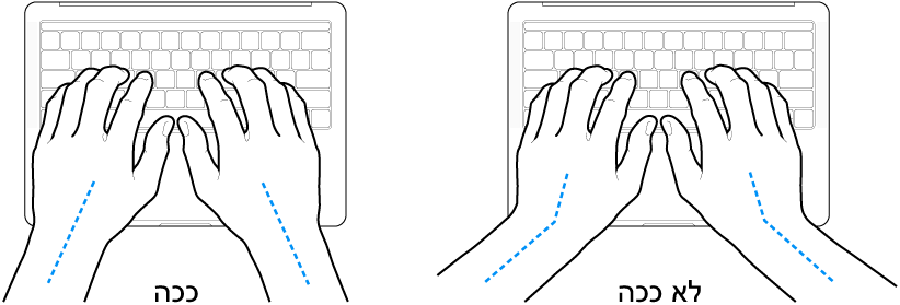 ידיים מעל מקלדת, להדגמת מנח נכון ומנח שגוי של כף היד ושורש כף היד.