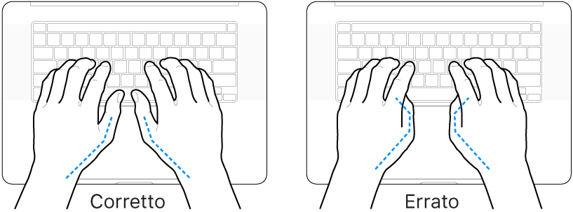 Mani posizionate su una tastiera che illustrano il posizionamento corretto ed errato dei pollici.