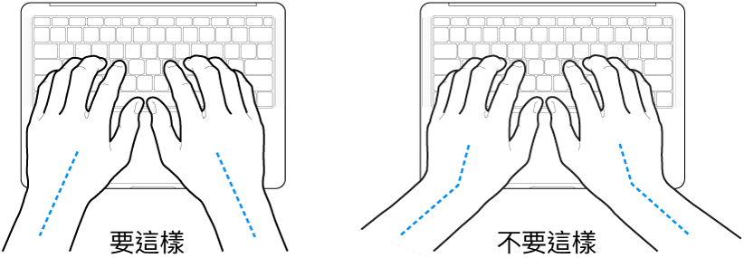 雙手置於鍵盤上，分別顯示正確與不正確的手肘與雙手對稱擺放位置。