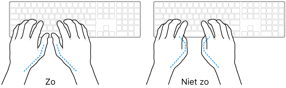Handen boven een toetsenbord, waarbij de goede en verkeerde stand van de duimen wordt aangegeven.
