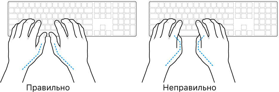 Руки розташовано над клавіатурою й показано правильне та неправильне положення великих пальців.
