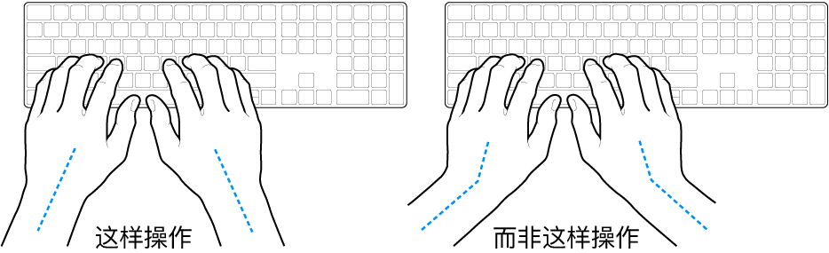 手掌放在键盘上方，显示手腕和手掌的正确对齐位置和错误对齐位置。