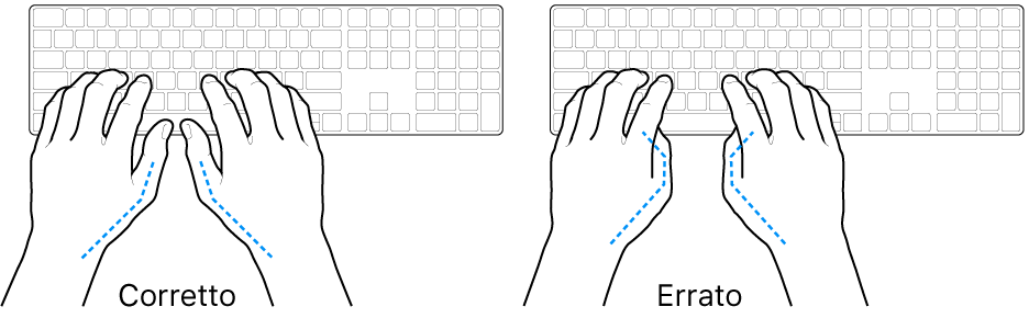 Mani posizionate su una tastiera che illustrano il posizionamento corretto ed errato dei pollici.