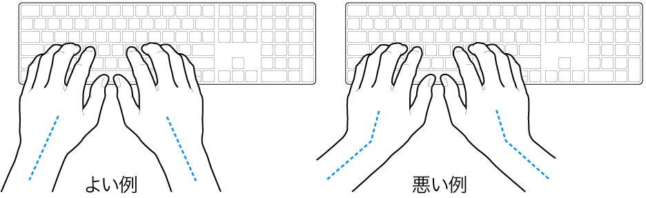 キーボードに置かれた手。手首と手の適切な位置関係と不適切な位置関係を示しています。