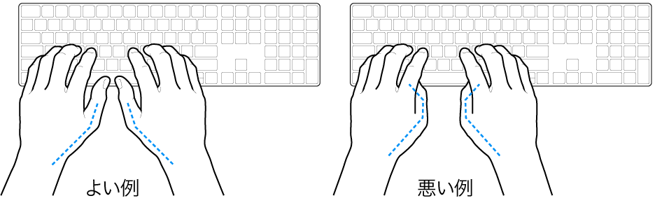 キーボードに置かれた手。親指の適切な位置と不適切な位置を示しています。