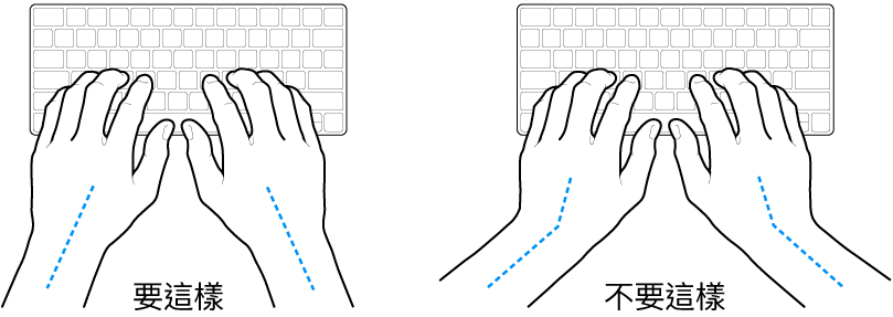 雙手置於鍵盤上，分別顯示正確與不正確的手肘與雙手對稱擺放位置。