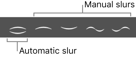 Figure. Part box showing automatic and manual slurs.