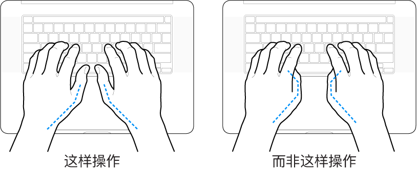 手掌放在键盘上方，显示拇指的正确放置和错误放置。