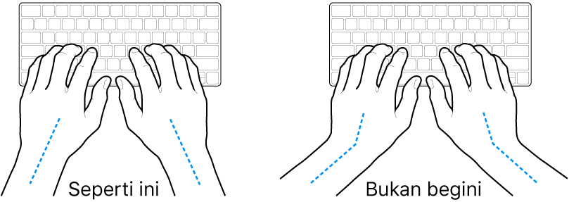 Tangan diposisikan di atas papan ketik, menampilkan penyejajaran pergelangan tangan dan tangan yang benar dan salah.