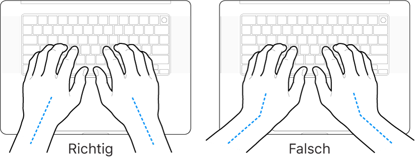 Tastatur und Hände in richtiger und falscher Haltung von Handgelenk und Händen