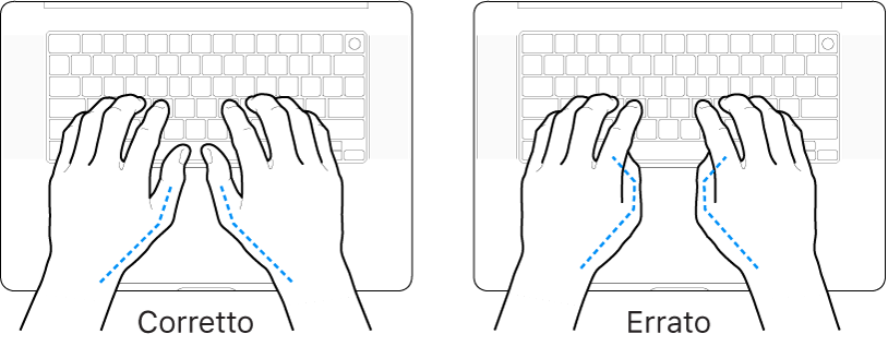 Mani posizionate su una tastiera che illustrano il posizionamento corretto ed errato dei pollici.