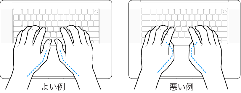 キーボードに置かれた手。親指の適切な位置と不適切な位置を示しています。