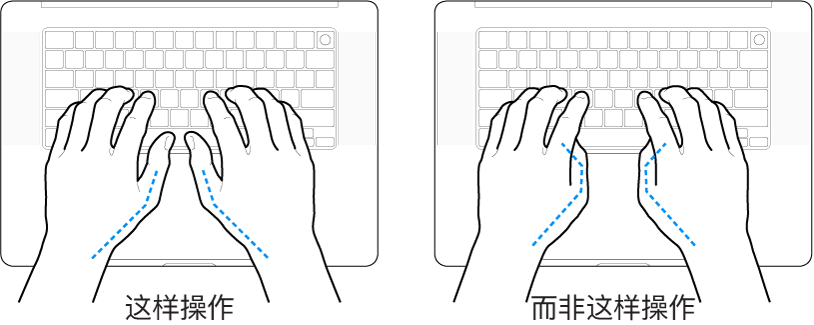 手掌放在键盘上方，显示拇指的正确放置和错误放置。