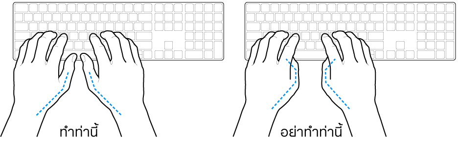 มือวางอยู่เหรือแป้นพิมพ์ แสดงตำแหน่งการวางนิ้วหัวแม่มือที่ถูกต้องและไม่ถูกต้อง