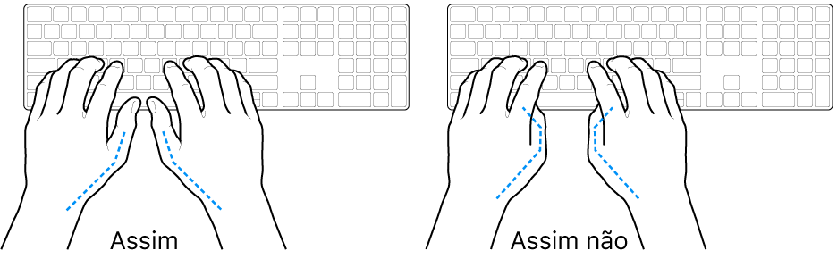 As mãos posicionadas sobre um teclado a mostrar a colocação correta e incorreta dos polegares.