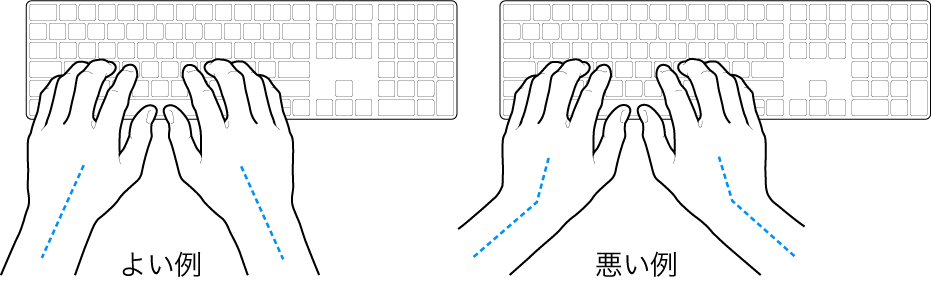 キーボードに置かれた手。手首と手の適切な位置関係と不適切な位置関係を示しています。