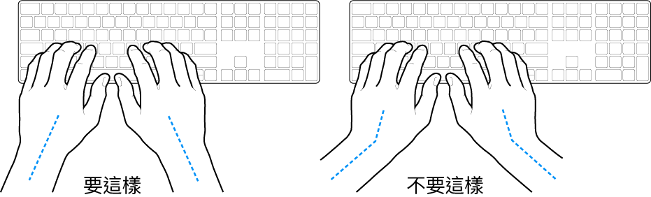 雙手置於鍵盤上，分別顯示正確與不正確的手肘與雙手對稱擺放位置。