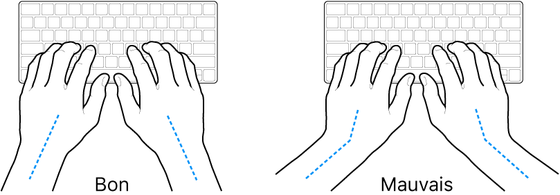 Mains placées sur un clavier, montrant le bon et le mauvais alignement des poignets et des mains.