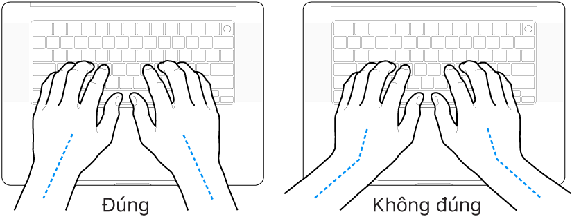 Các bàn tay đặt phía trên bàn phím, minh họa cách đặt cổ tay và bàn tay đúng và sai.