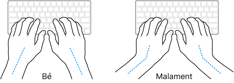 Unes mans posades sobre un teclat mostrant l’alineació correcta i incorrecta del canell i la mà.