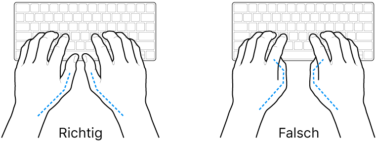 Tastatur und Hände in richtiger und falscher Haltung der Daumen