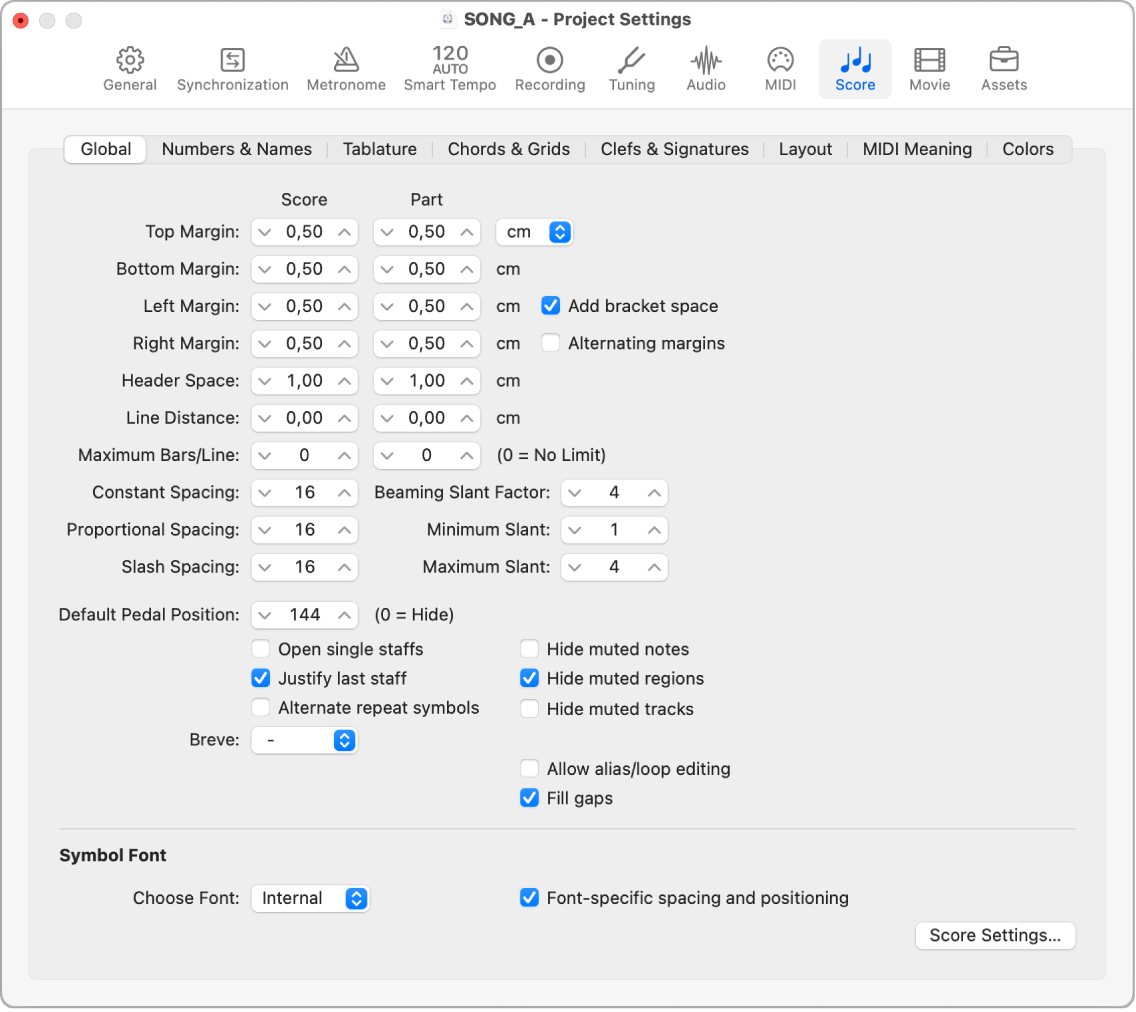 Figure. Global Score project settings.