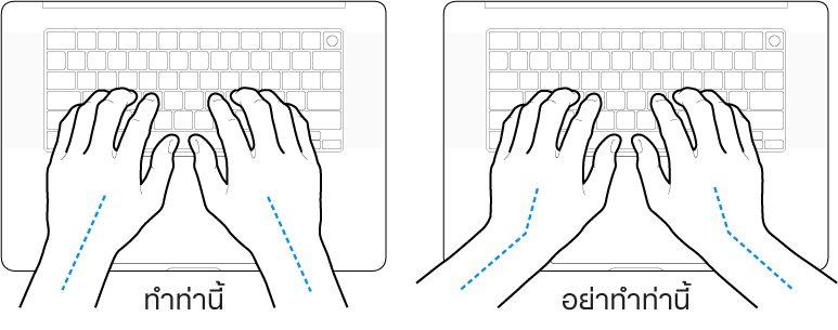 มือวางอยู่เหรือแป้นพิมพ์ แสดงตำแหน่งการวางข้อมือและแขนที่ถูกต้องและไม่ถูกต้อง