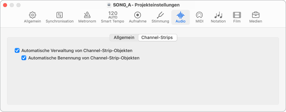 Abbildung. Projekteinstellungen „Channel-Strips“.