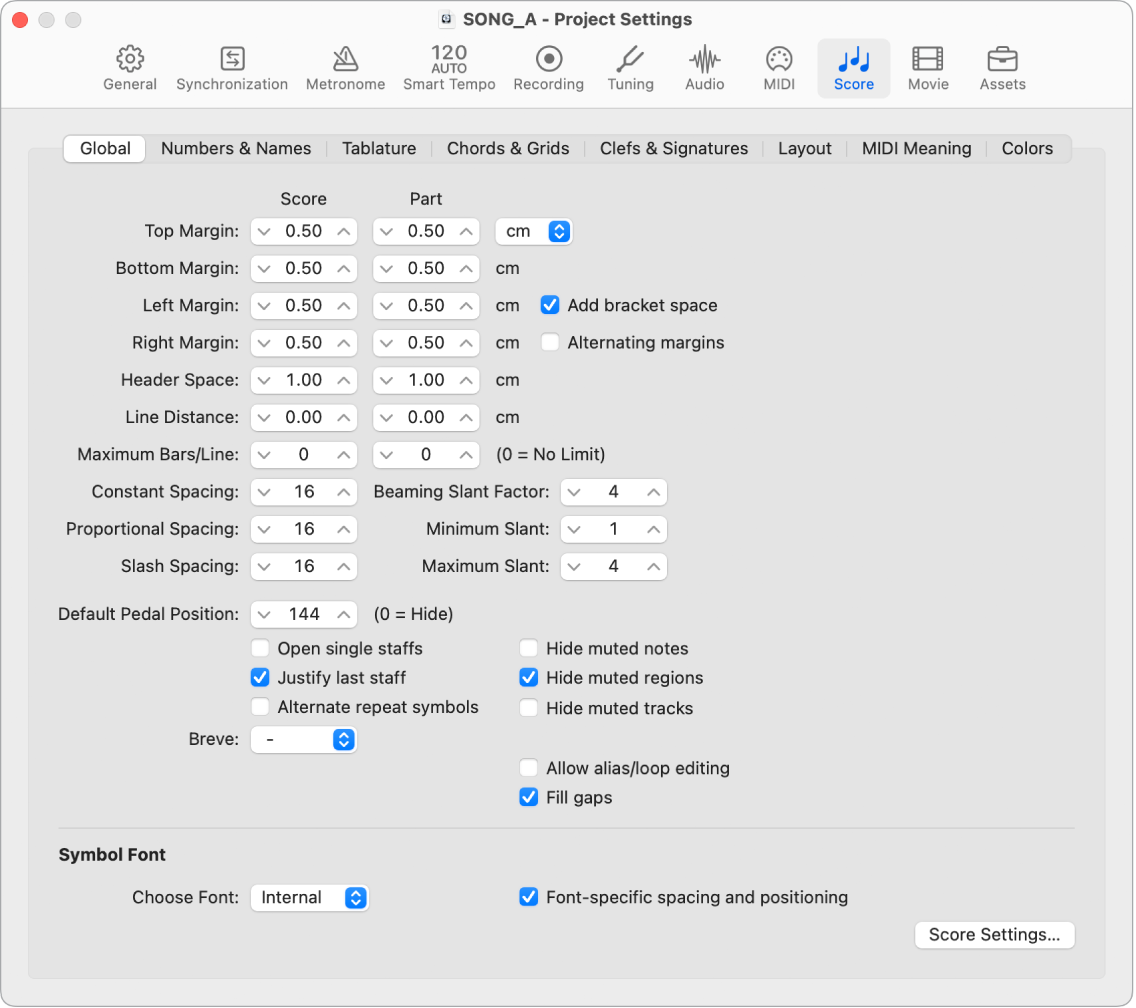 Figure. Global Score project settings.