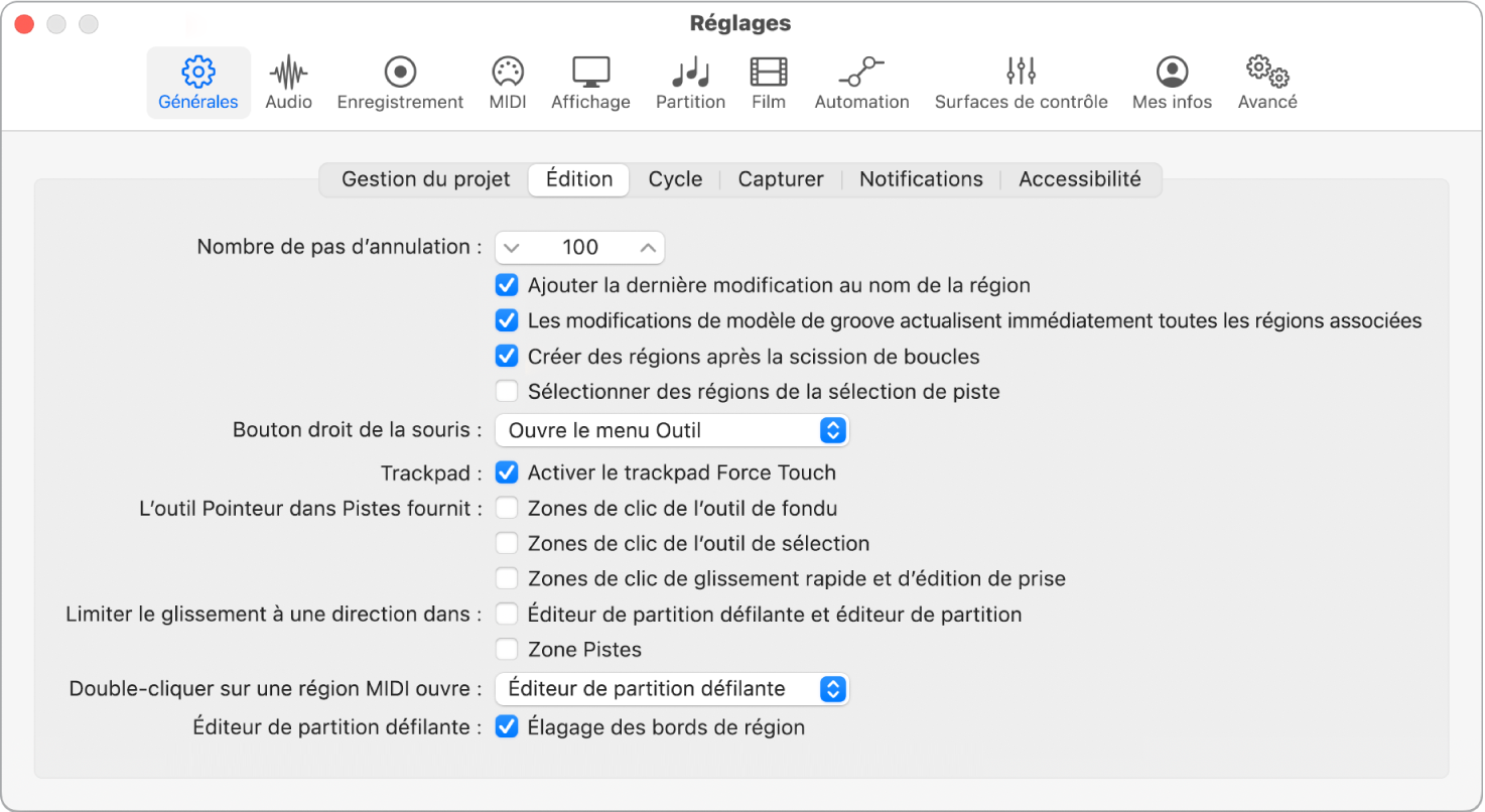 Figure. Réglages d’édition.