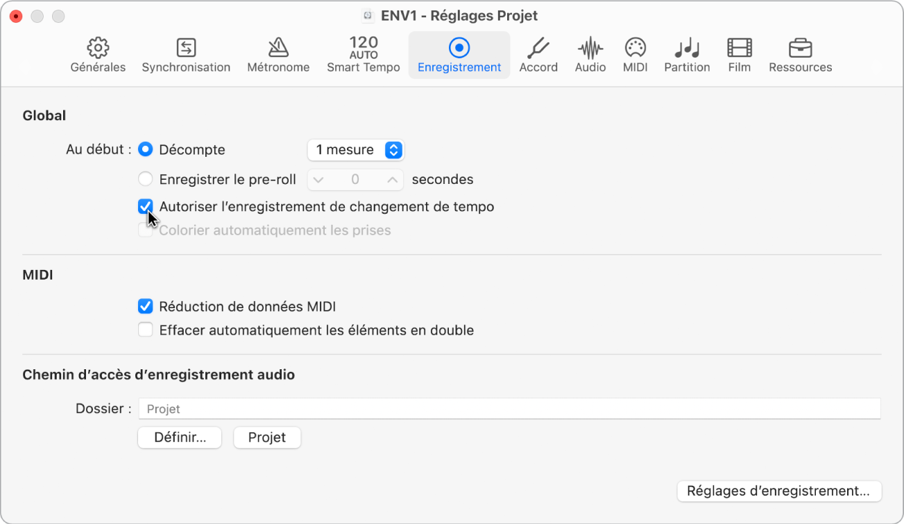 Figure. Sous-fenêtre Enregistrement des réglages de projet.