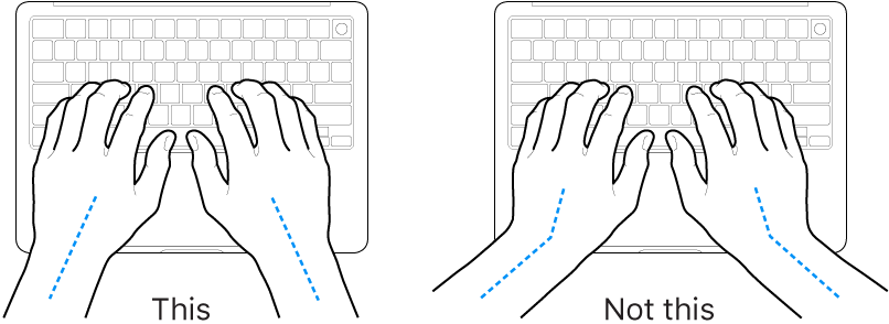 Hands positioned over a keyboard, showing correct and incorrect wrist and hand alignment.