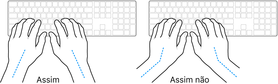 As mãos posicionadas sobre um teclado a mostrar alinhamentos corretos e incorretos das mãos e dos pulsos.