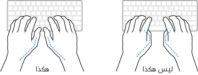 يدان موضوعتان على لوحة مفاتيح، ويظهر الوضع الصحيح وغير الصحيح للإبهامين.