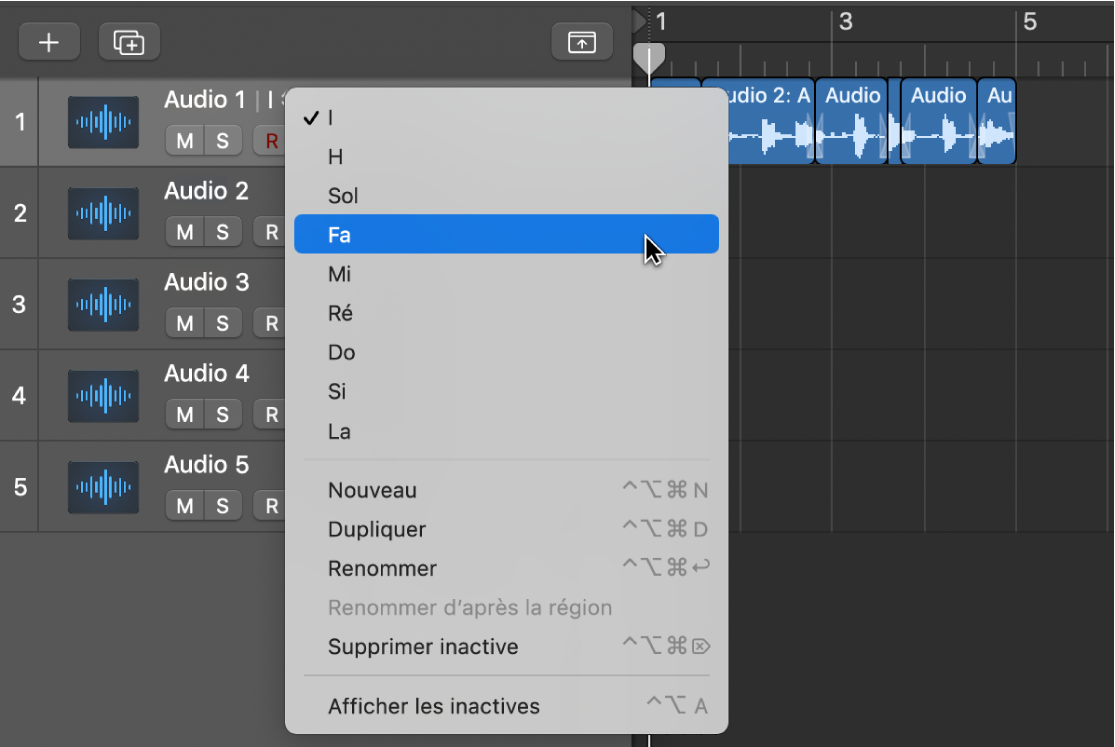 Figure. Prises accessibles comme alternatives de prise.