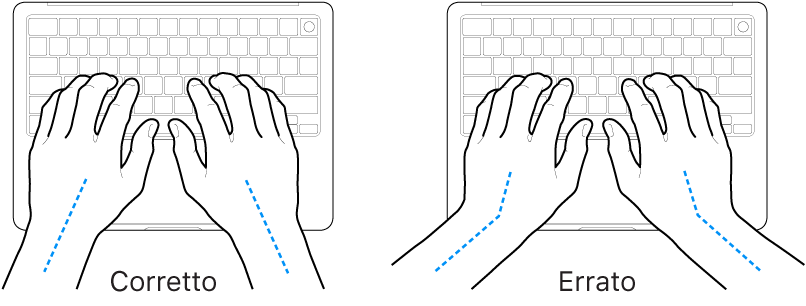 Mani posizionate su una tastiera che illustrano l'allineamento corretto ed errato di polso e mano.